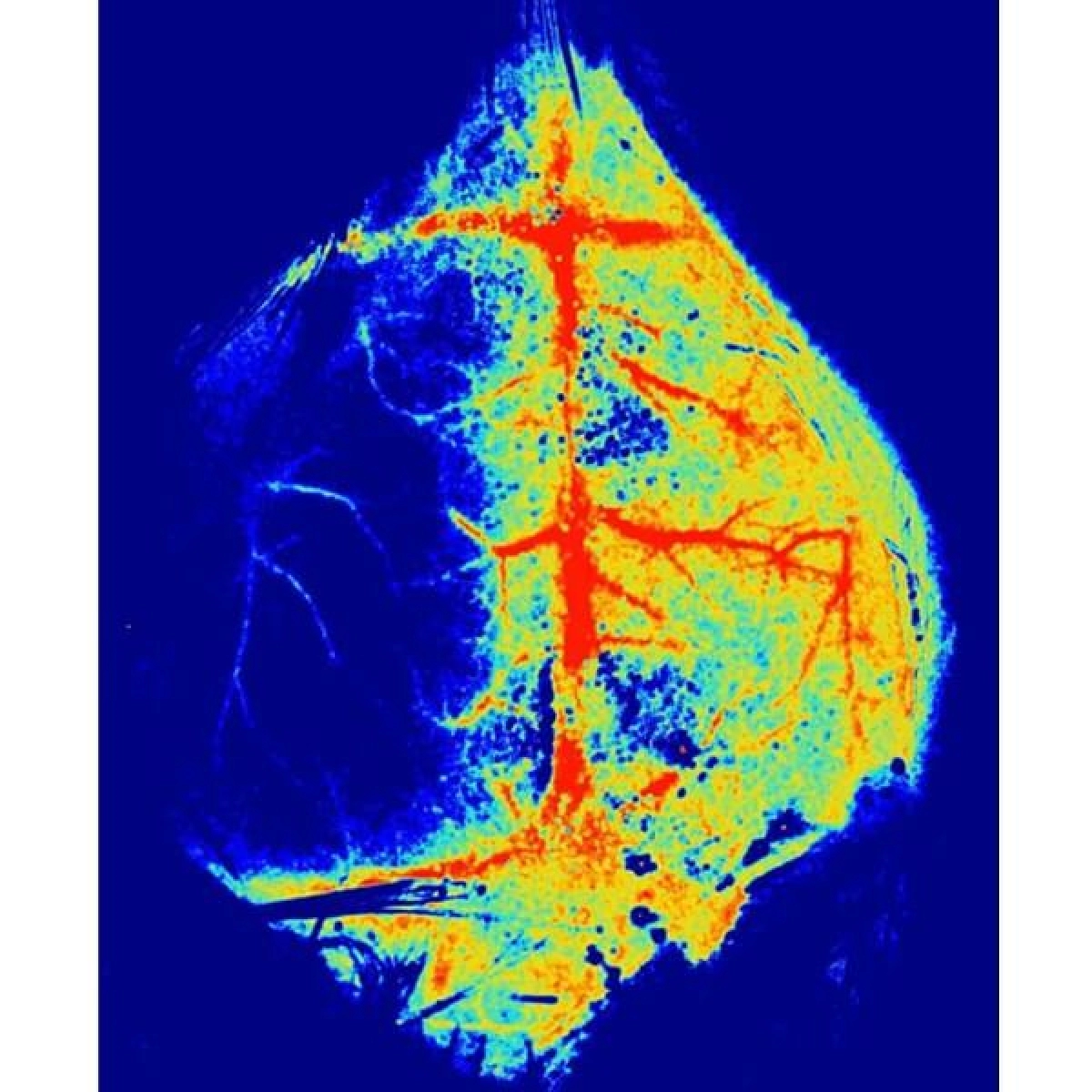 RFLSI III Laser Speckle Imaging System RWD - 2