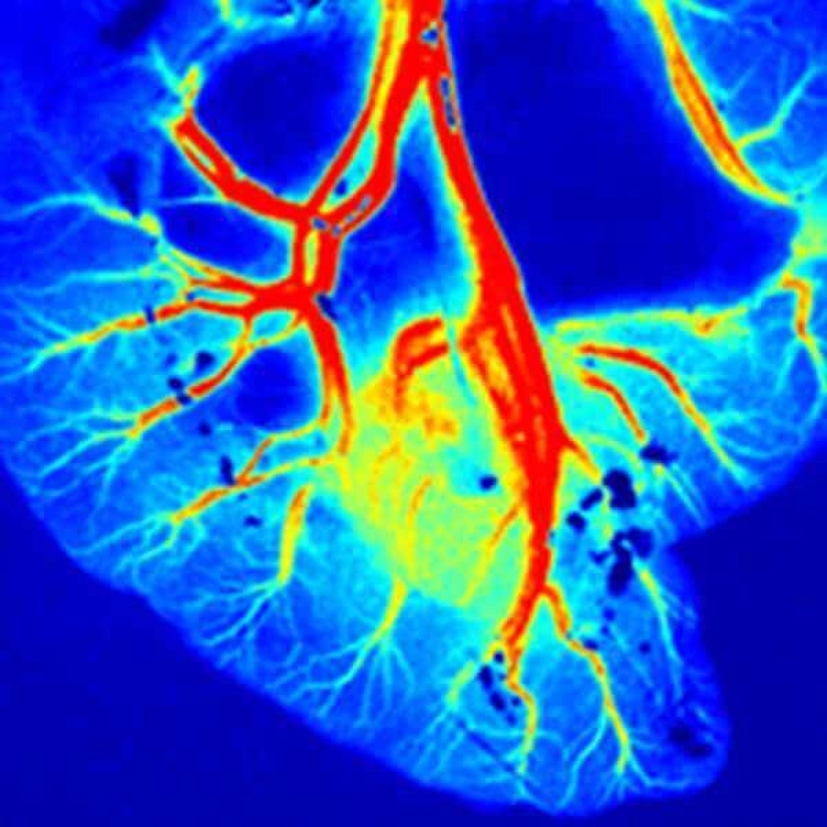 RFLSI III Laser Speckle Imaging System RWD - 4